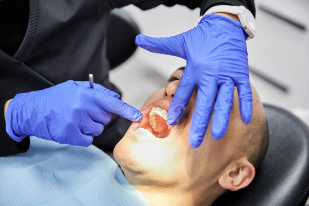 Best Emergency Dental Care for Broken or Chipped Teeth in Ivins, UT